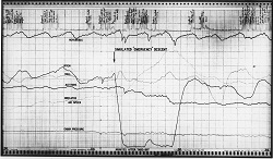 Chart printout of small portion of the 23 March 1962 flight with cockpit voice annotation added by Dr Warren